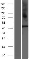 GPR73B (PROKR2) Human Over-expression Lysates NM_144773
