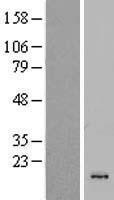 CSTL1 Human Over-expression Lysates NM_138283