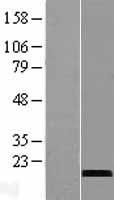 CST9L Human Over-expression Lysates NM_080610