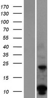 DUSP15 Human Over-expression Lysates NM_177991