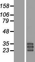SPLUNC3 (BPIFA3) Human Over-expression Lysates NM_001042439