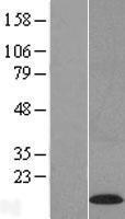 C22orf39 Human Over-expression Lysates NM_173793