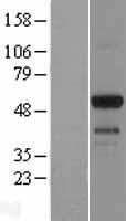 EMID1 Human Over-expression Lysates NM_133455