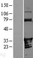 ANKRD54 Human Over-expression Lysates NM_138797