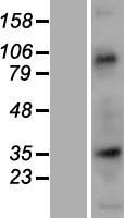 Nup53 (NUP35) Human Over-expression Lysates NM_138285