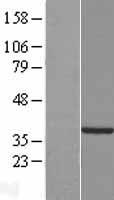 C2orf60 (TYW5) Human Over-expression Lysates NM_001039693