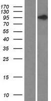 DIS3L2 Human Over-expression Lysates NM_152383