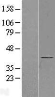BBS5 Human Over-expression Lysates NM_152384