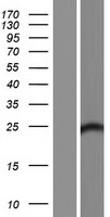 FAM168B Human Over-expression Lysates NM_001009993