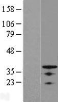 OSR1 Human Over-expression Lysates NM_145260