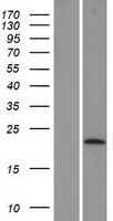 LYPD6 Human Over-expression Lysates NM_194317