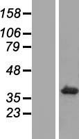 TMEM198 Human Over-expression Lysates NM_001005209