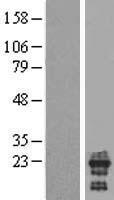 C2orf50 Human Over-expression Lysates NM_182500