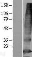 ls130814 slc66a3 human over expression lysates nm 152391 wb testing 1