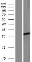 FBXO36 Human Over-expression Lysates NM_174899