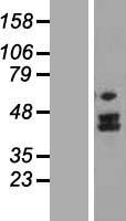 MTERFD2 (MTERF4) Human Over-expression Lysates NM_182501