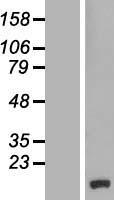 CCDC58 Human Over-expression Lysates NM_001017928