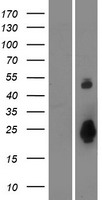 ls131149 otol1 human over expression lysates nm 001080440 wb testing 1