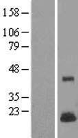 LYZL4 Human Over-expression Lysates NM_144634