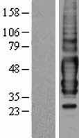 TPRA1 Human Over-expression Lysates NM_001136053