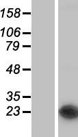 NUDT16 Human Over-expression Lysates NM_152395