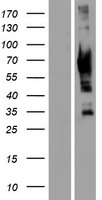 GRK7 Human Over-expression Lysates NM_139209