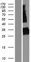 ls132204 synpr human over expression lysates nm 001130003 wb testing 1