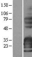 ls132204 synpr human over expression lysates nm 144642 wb testing 2