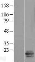 LSMEM2 Human Over-expression Lysates NM_153215