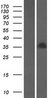 H1oo (H1FOO) Human Over-expression Lysates NM_153833