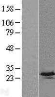 C4orf33 Human Over-expression Lysates NM_173487
