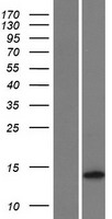 TMEM155 Human Over-expression Lysates NM_152399