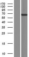 TENR (ADAD1) Human Over-expression Lysates NM_001159295