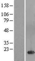 FAM241A Human Over-expression Lysates NM_152400