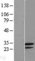 GNPDA2 Human Over-expression Lysates NM_138335