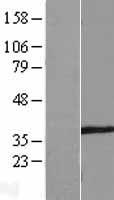 SPATA4 Human Over-expression Lysates NM_144644