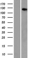 ls132949 aasdh human over expression lysates nm 181806 wb testing 1