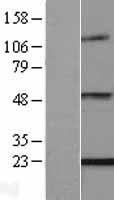 ls133121 enpp6 human over expression lysates nm 153343 wb testing 1