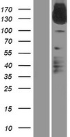 IL31RA Human Over-expression Lysates NM_139017