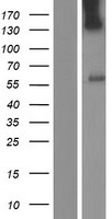 UGT3A1 Human Over-expression Lysates NM_152404