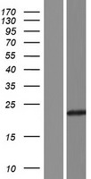 UBE2QL1 Human Over-expression Lysates NM_001145161