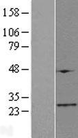 ATPSCKMT Human Over-expression Lysates NM_199133