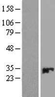 CMBL Human Over-expression Lysates NM_138809