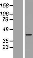 POU5F2 Human Over-expression Lysates NM_153216