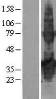 TMEM171 Human Over-expression Lysates NM_173490