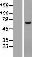 POC5 Human Over-expression Lysates NM_152408