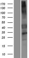 GPCR 2037 (GPR151) Human Over-expression Lysates NM_194251