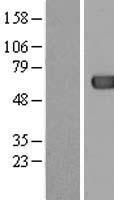 ACOT12 Human Over-expression Lysates NM_130767