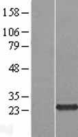 C5orf24 Human Over-expression Lysates NM_001135586