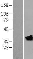CLVS2 Human Over-expression Lysates NM_001010852